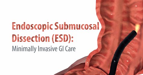 Endoscopic Submucosal Dissection: Minimally Invasive GI Care