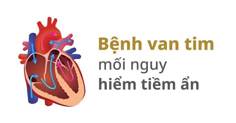 Bệnh van tim - mối nguy hiểm tiềm ẩn