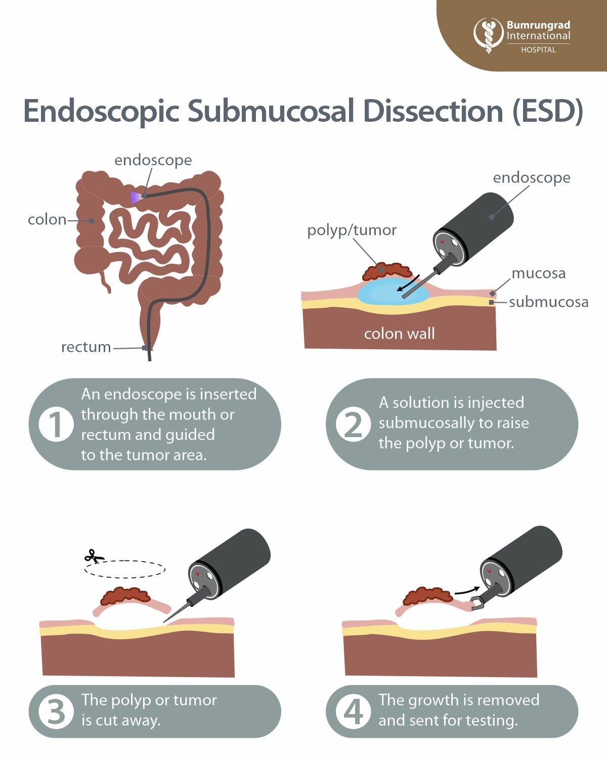 ESD-technique.jpg