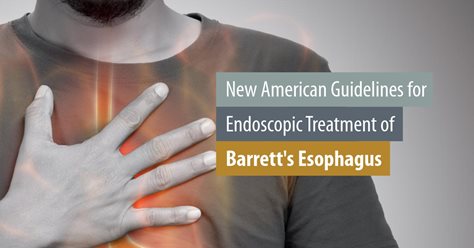 New American Guidelines for Endoscopic Treatment of Barrett
