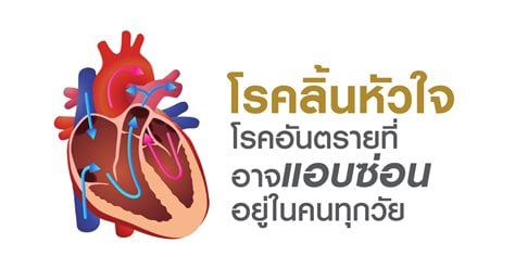 โรคลิ้นหัวใจ โรคอันตรายที่อาจแอบซ่อนอยู่ในทุกวัย