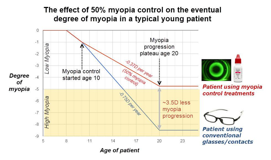 Why-the-myopia-control-are-implrtant.png
