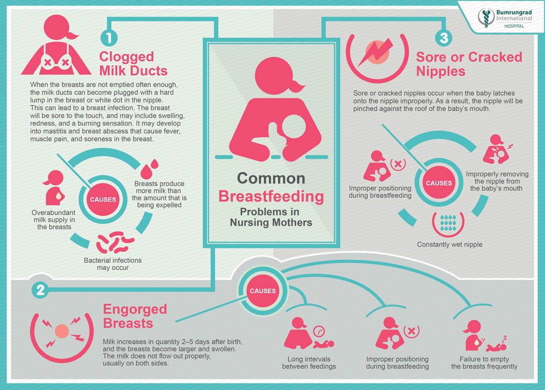Breastfeeding Problems and Solutions, Causes and Treatment for  Breastfeeding Complications