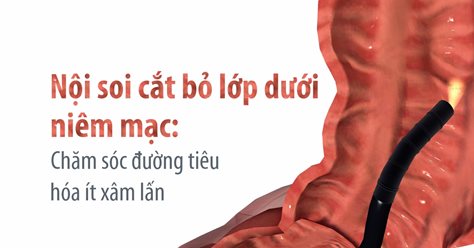 Nội soi cắt bỏ lớp dưới niêm mạc: Chăm sóc đường tiêu hóa ít xâm lấn