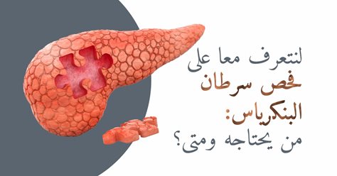 لنتعرف معا على فحص سرطان البنكرياس: من يحتاجه ومتى؟