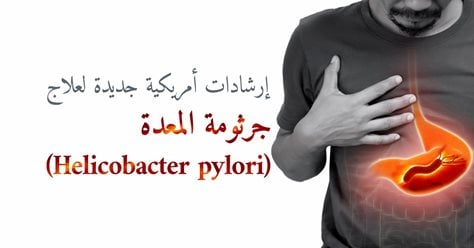  (Helicobacter pylori) إرشادات أمريكية جديدة لعلاج جرثومة المعدة