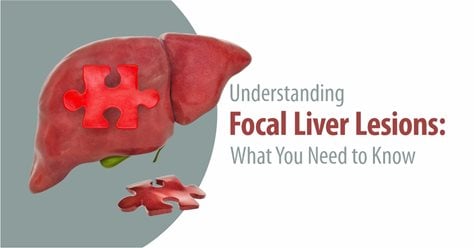 Understanding Focal Liver Lesions: What You Need to Know