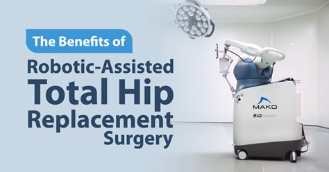 The Benefits of Robotic-Assisted Total Hip Replacement Surgery